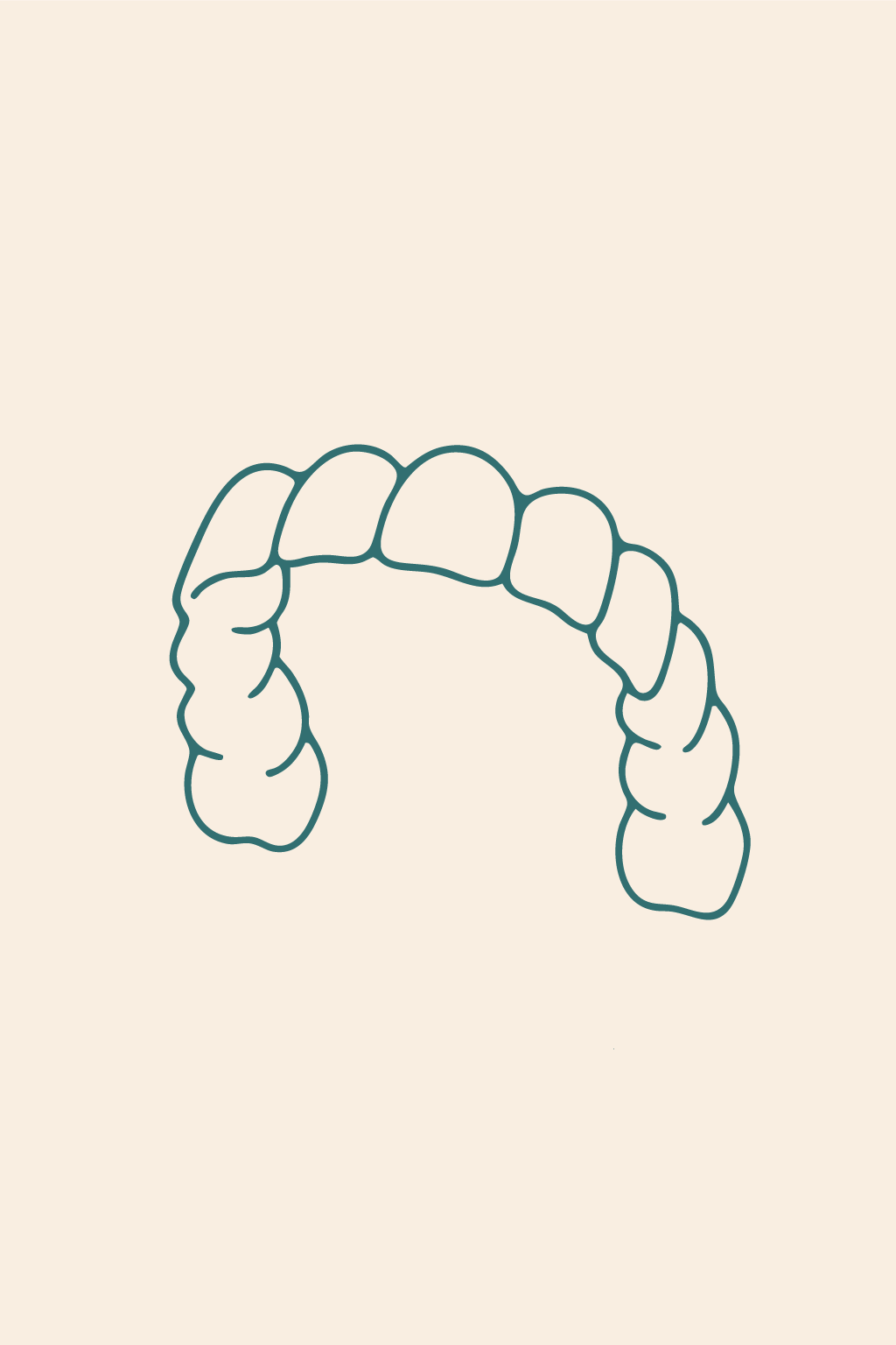 Illustration d'une gouttière transparente