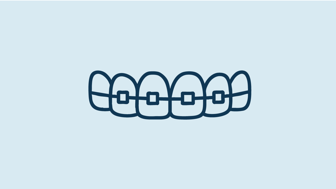 Illustration de bagues fixes